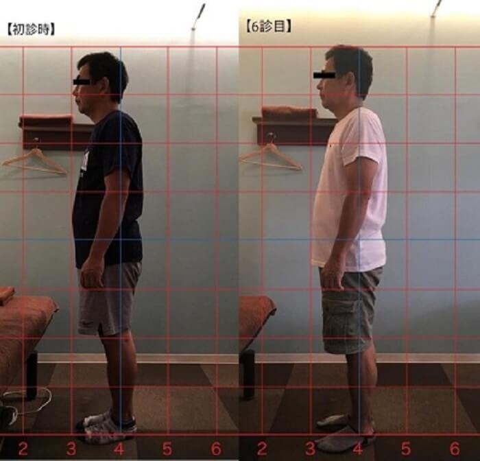 吹田市江坂の整体・鍼灸